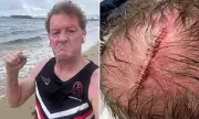 Ricky Nixon's Horror Injury: Footy Agent Rushed to Hospital After Gruesome Accident | Exclusive