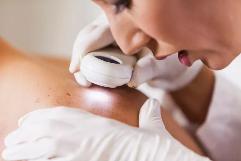 Breakthrough in Skin Cancer Prevention: Common Vitamin Shows Remarkable Results