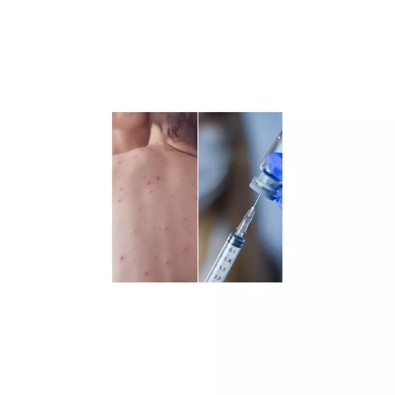 Health Alert: The Little-Known Virus Spreading Rapidly Across UK - Key Signs You Must Know