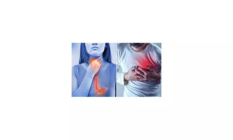 Heart Attack Alert: The Hidden Danger of Acid Reflux You Need to Know About