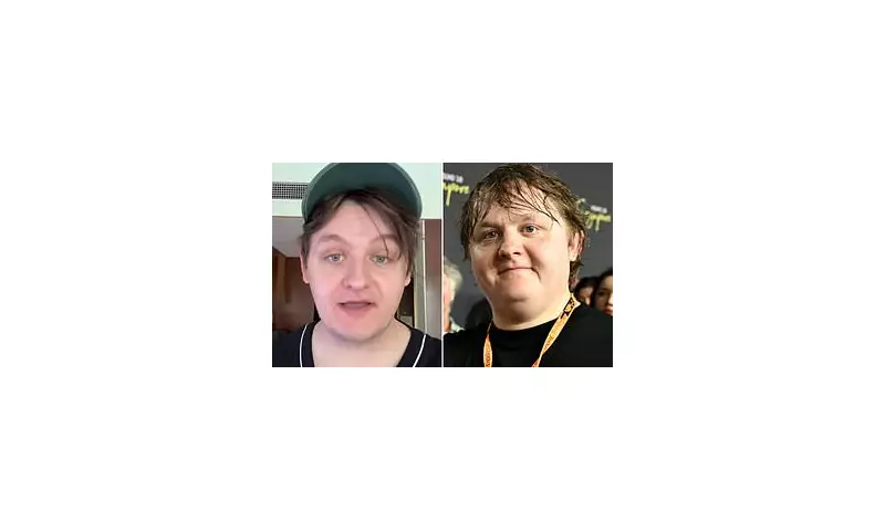 Lewis Capaldi's Brother Steals Spotlight with Hilarious TikTok Channel Mocking F1 Mishap Likeness