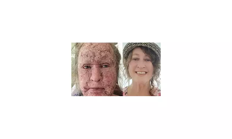 Medical Breakthrough: Revolutionary New Treatment Offers Hope for Millions of Eczema Sufferers