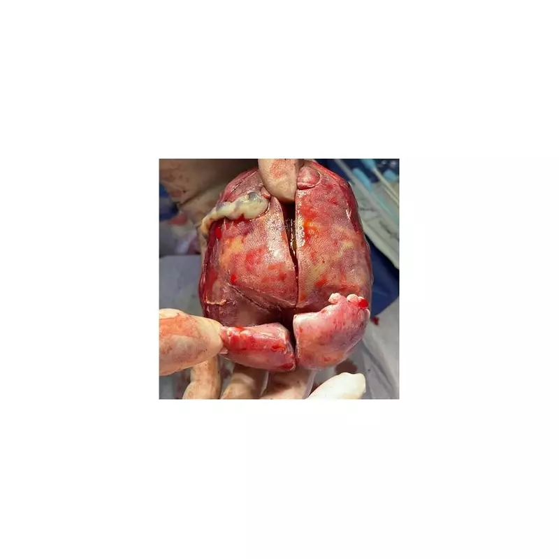 Miracle Baby Survives Rare Twin Condition After Doctors Discover Shocking Truth