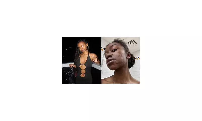 Model's Agony: Acid Attack Survivor Reveals Her Skin Is Deteriorating Years After Brutal Assault