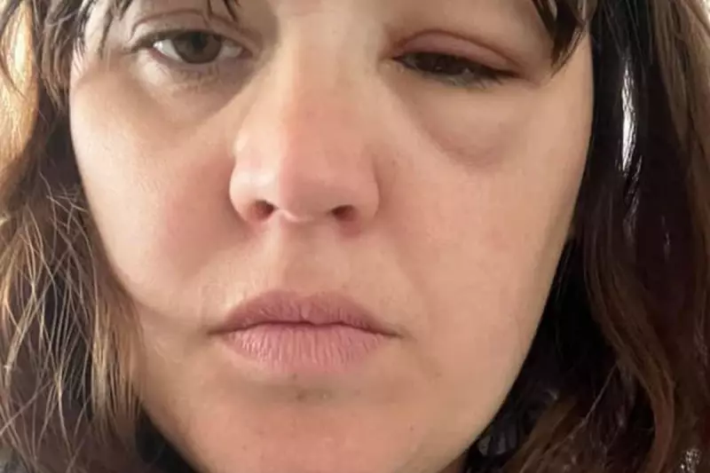 NHS Surgeons Forced to Operate in Corridors as Patient Backlog Crisis Deepens