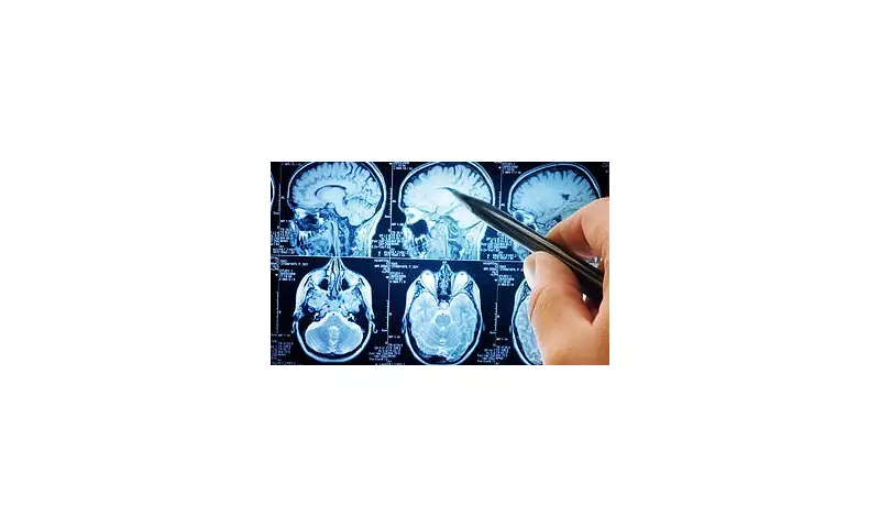 Parkinson's Disease Breakthrough: Scientists Discover Critical Protein Trigger in Groundbreaking UK Research