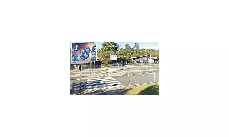 Queensland Faces Urgent Measles Crisis as Multiple Cases Emerge Across the State