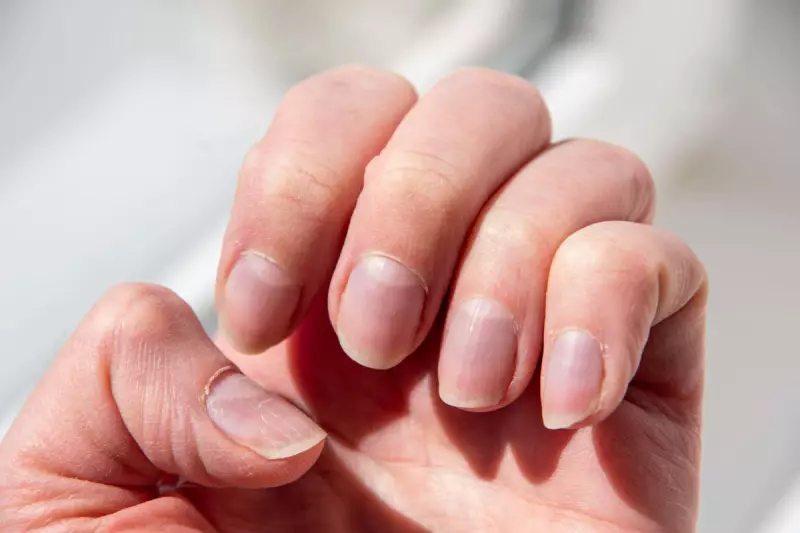 Stress Nails: The Hidden Health Warning Your Fingernails Are Sending
