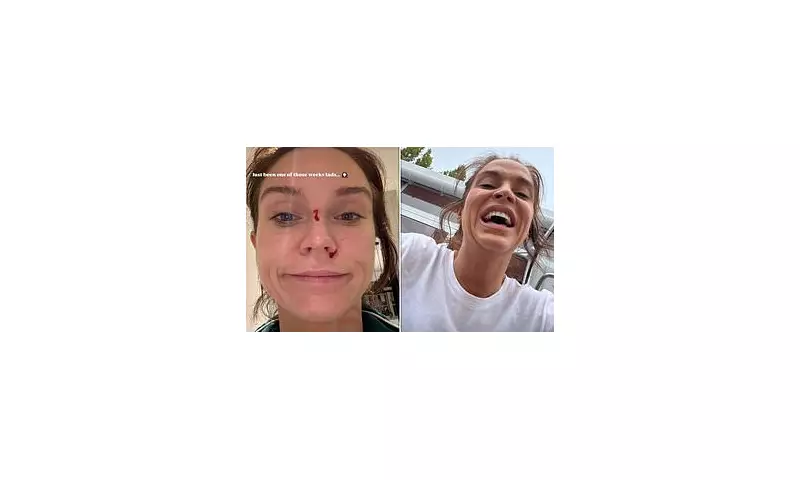 Strictly Drama: Vicky Pattinson Chips Tooth in Lift Mishap with Kai Widdrington Amid Rehearsal Nightmares