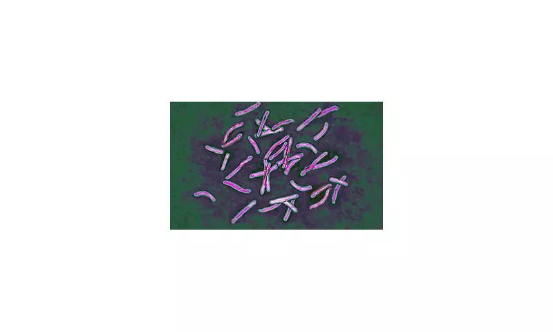 TB Alert: UK Health Chiefs Sound Alarm as World's Deadliest Infection Makes Worrying Comeback