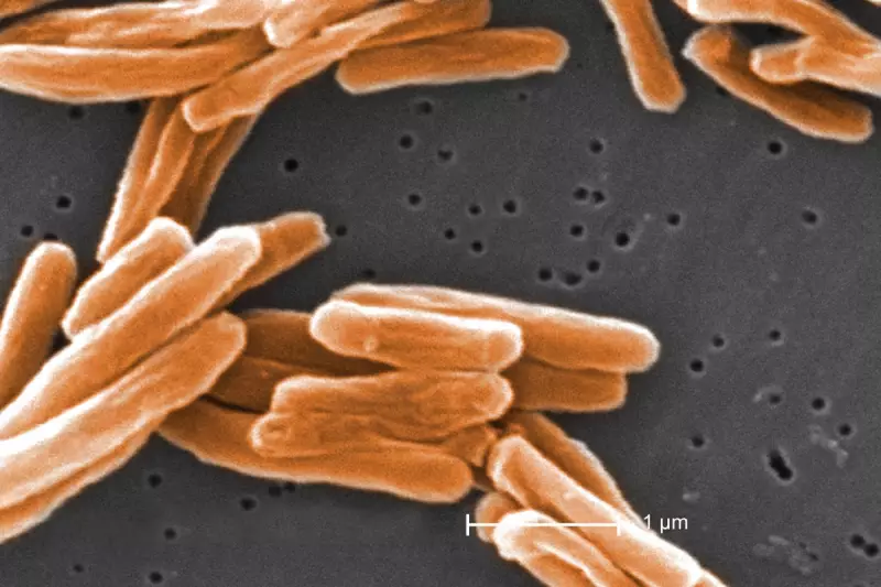 TB Alert: UK Sees Sharp Rise in Tuberculosis Cases as Health Experts Sound Alarm