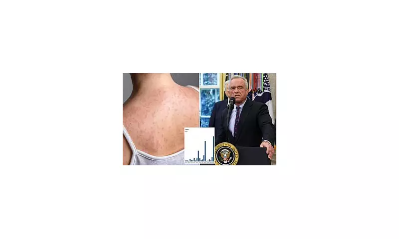 Texas Measles Outbreak: Urgent Health Alert as Cases Emerge - Know the Signs