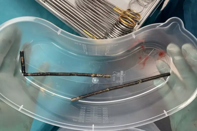 Toddler's Terrifying Ordeal: Life-Saving Surgery After Swallowing 10 Deadly Magnets