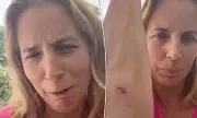 A Place in the Sun's Jasmine Harman Hospitalised After Terrifying Marble Staircase Fall
