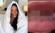 Australian Influencer's Dental Disaster: Shocking Accident Leaves Her With Shattered Smile