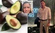 Avocado Alert: ER Doctors Issue Urgent Safety Warning After Thousands Hospitalised