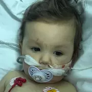 Baby's Red Ears Were Silent Alarm for Deadly Sepsis - Parents' Quick Thinking Saves Life