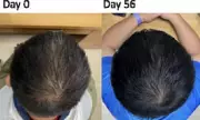 Baldness Breakthrough: Scientists Discover Simple 'Communication' Fix That Could Reverse Hair Loss