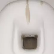 Banish Ugly Brown Toilet Stains Forever: The Simple £1.99 Solution That Actually Works