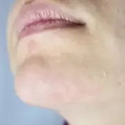 Beauty Bargain Hunt: Shoppers Claim £35 At-Home Hair Removal Device Rivals Salon Laser Results