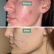 Beauty Breakthrough: 61p-a-Day Tablets That Fight Wrinkles Now on Sale