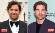 Bradley Cooper's Changing Appearance: Top Plastic Surgeon Analyses The Oscar Winner's 'Taut' Visage