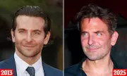 Bradley Cooper's Dramatic New Look Sparks Plastic Surgery Speculation Among Top Surgeons