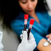 Breakthrough Blood Test for Chronic Fatigue Syndrome Offers Hope for Millions