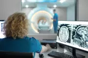 Breakthrough MRI Scan Could Revolutionise Early Dementia Detection in the UK