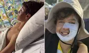 Chemical Burns Horror: Boy Severely Injured by Deodorant Spray on Australia's Gold Coast