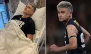 Comedian Dave Hughes Hospitalised After AFL Legends Game Injury: 'Lungs Filled With Fluid'