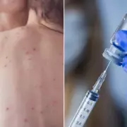 Health Alert: The Little-Known Virus Spreading Rapidly Across UK - Key Signs You Must Know