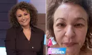Loose Women's Nadia Sawalha Reveals Shocking Reason Behind Her Dramatically Swollen Face