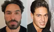 Mario Falcone's Age-Defying Secrets: From Salmon Sperm Facials to Dermal Fillers - The Ultimate Dad Glow-Up
