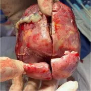 Miracle Baby Survives Rare Twin Condition After Doctors Discover Shocking Truth