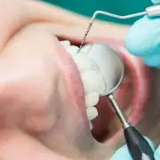 NHS Dental Crisis: Millions Eligible for FREE Treatment - Check If You Qualify Now