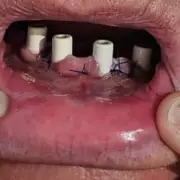 NHS Worker's Shocking Confession: 'I Wouldn't Trust My Own Hospital for Treatment'