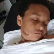 Nine-Year-Old Boy's Terrifying Shark Encounter: 'I Thought I Was Going To Die'