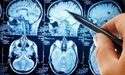 Parkinson's Disease Breakthrough: Scientists Discover Critical Protein Trigger in Groundbreaking UK Research