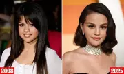 Plastic Surgeons Analyse Selena Gomez's Nose: Has She Had Rhinoplasty Surgery?