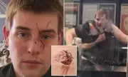 Shocking Bite Attack at Hungry Jack's: Drunken Assault on Augusta Highway Leaves Victim Injured