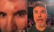 Simon Cowell's BGT Return: The Real Reason Behind His Mysterious Absence and Visible Head Injury Revealed
