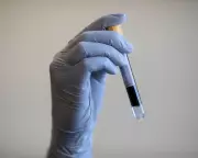 Targeted Prostate Screening Could Save Thousands of Lives in UK, Experts Say