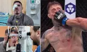 Tom Aspinall's UFC 304 Fight in Jeopardy After Shocking Eye Injury During Sparring Session