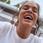 Vicky Pattison's Dental Disaster: I Chipped My Tooth on a Protein Bar!