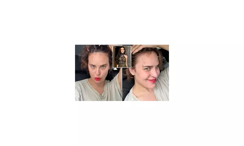 Demi Moore's Daughter Tallulah Willis Reveals Heartbreaking Struggle With Skin-Picking Disorder