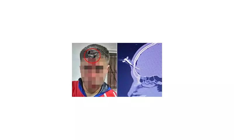 Footballer Stabbed with Car Key in Forehead at Youth Match in Argentina