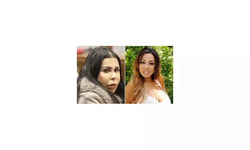 Malibu Actress Death: Illegal Cosmetic Surgeon Sentenced After Fatal Buttock Enhancement