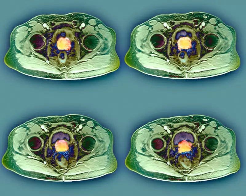 Prostate Cancer: Key Facts, Risks and Early Detection in the UK