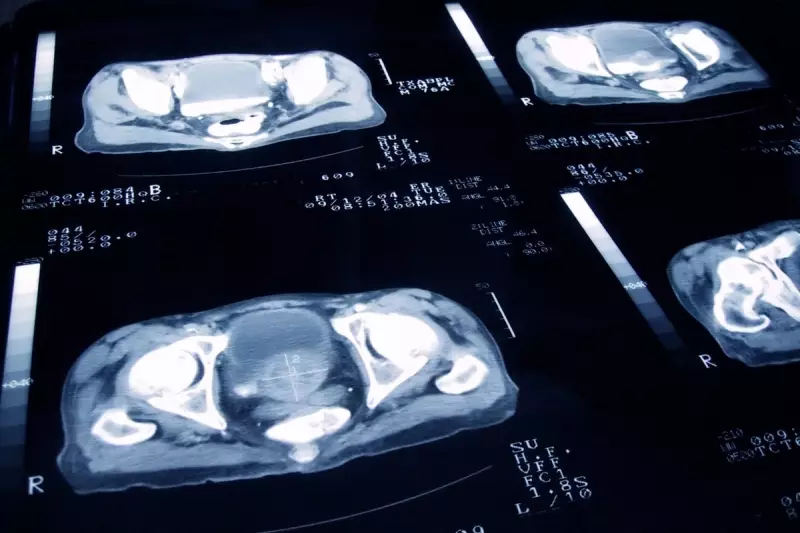 UK Poised for Major Prostate Cancer Screening Decision